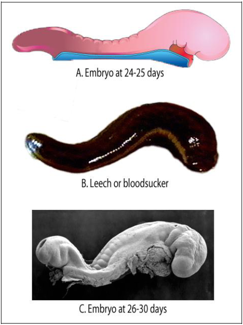 The leech-like appearance of the human embryo
