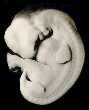Figure 1: Left lateral view of an embryo at Carnegie stage 14 (about 32 days). Photograph from the Carnegie Collection